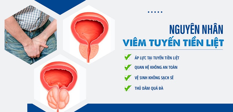 Tại sao nam giới dễ mắc phải bệnh viêm tuyến tiền liệt