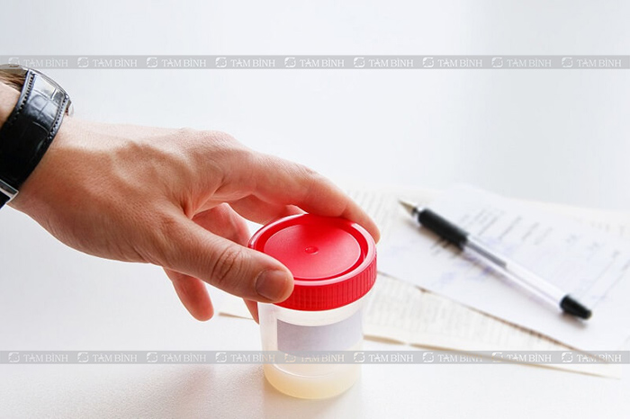 Những điều cần lưu ý trong điều trị tinh trùng hóa lỏng nhanh