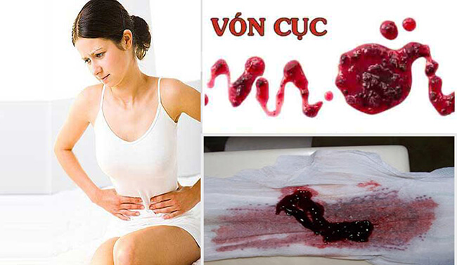 kinh nguyệt màu đen nguy hiểm đến mức nào