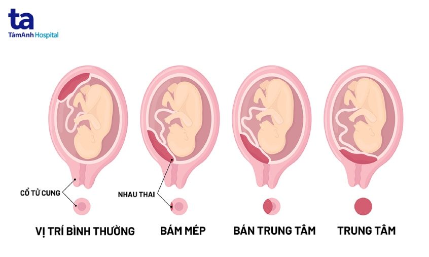 vị trí của rau tiền đạo