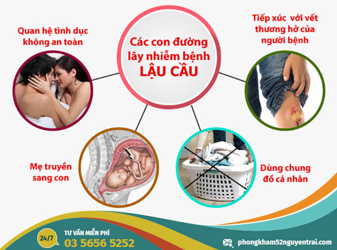 Các con đường lây nhiễm bệnh lậu