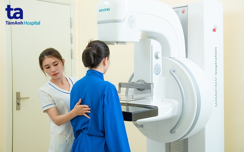 chẩn đoán điều trị ung thư vú