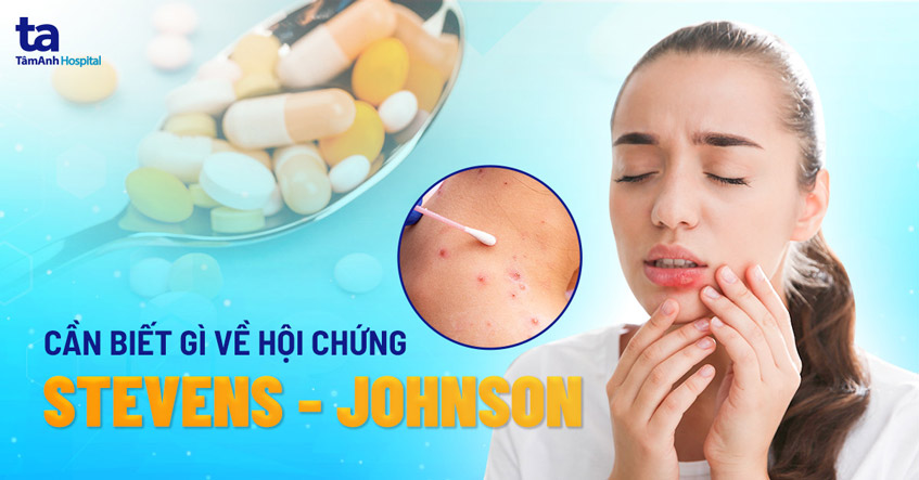 hội chứng stevens johnson