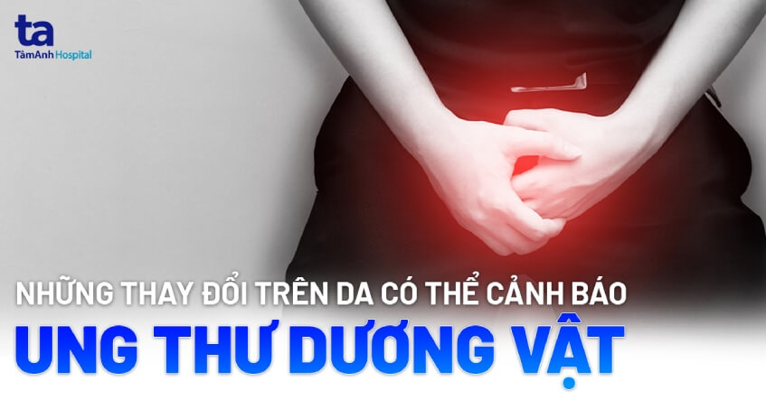 ung thư dương vật