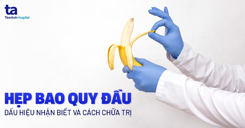 hẹp bao quy đầu