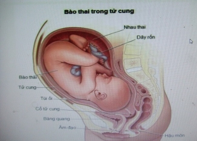 bao-thai-trong-tu-cung
