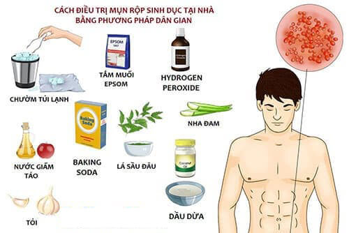 Cách điều trị mụn rộp sinh dục tại nhà