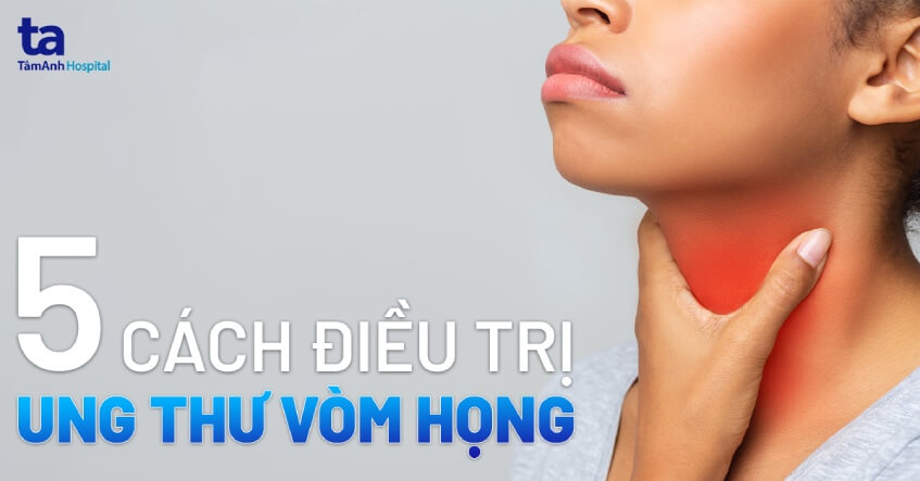 cách điều trị ung thư vòm họng