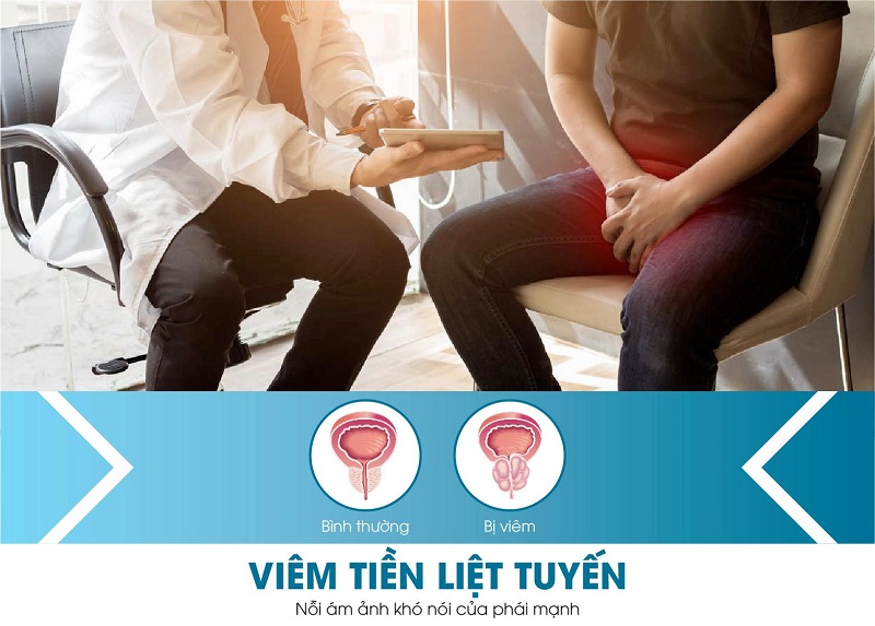 Bệnh viêm tuyến tiền liệt là gì