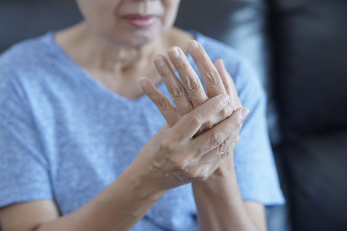 Hội chứng khô cần được điều trị đồng thời với các bệnh về khớp. Ảnh: Shutterstock
