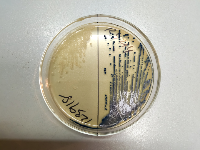 Nuôi cấy nước tiểu trong phòng thí nghiệm để xác định sự có mặt của vi khuẩn. Ảnh: Shutterstock.
