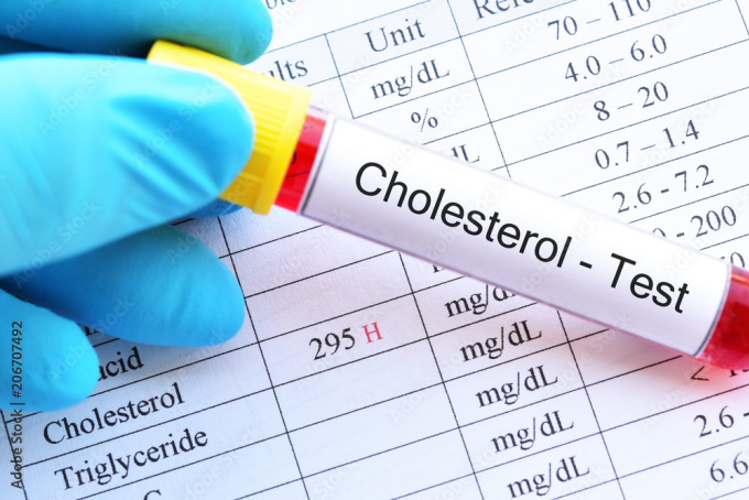 Lượng cholesterol và chất béo trung tính cao có thể dẫn đến những thay đổi rõ rệt trên da. Ảnh: Freepik
