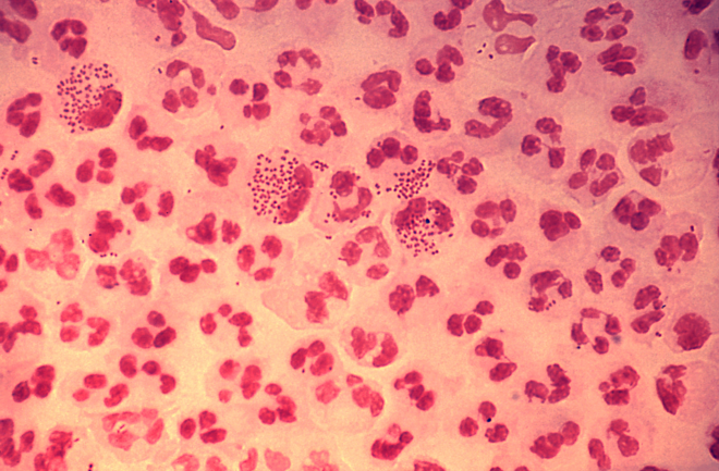Vi khuẩn Neisseria gonorrhoeae gây ra bệnh lậu. Ảnh: Alamy