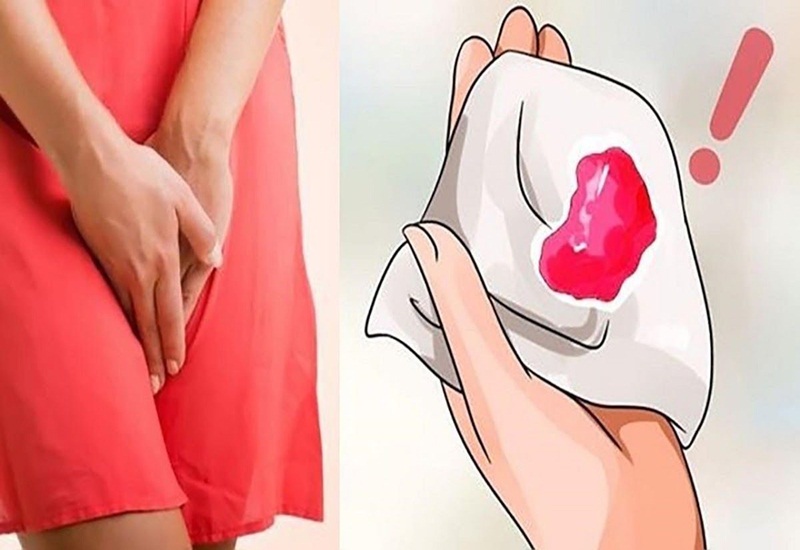 Mức độ nguy hiểm của ra máu bất thường ở âm đạo