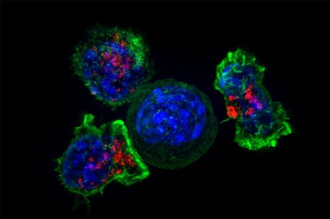 Một tế bào T (tế bào miễn dịch) đang bao quanh khối u ung thư. Ảnh: Viện Y tế Quốc gia