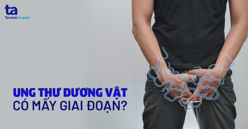 ung thư dương vật có mấy giai đoạn