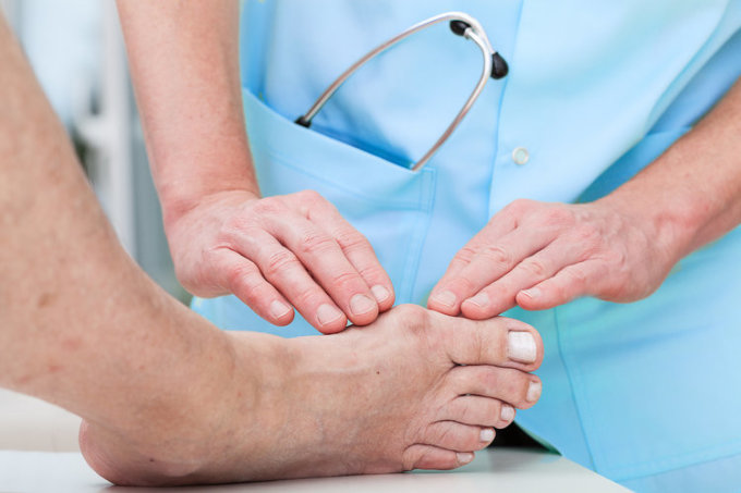 Người bị gout có thể gặp biến chứng liên quan đến thận, tim mạch, huyết áp... Ảnh: healthsite