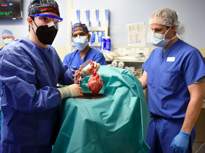 Bác sĩ Bartley Griffith kiểm tra quả tim lợn trước khi ghép cho bệnh nhân David Bennett. Ảnh:  University of Maryland School of Medicine