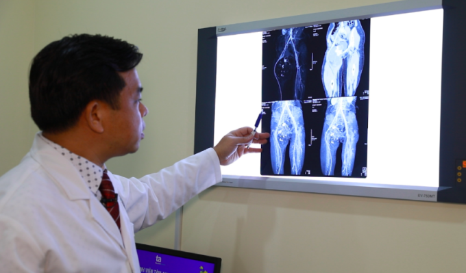 Bác sĩ Minh Lý chỉ ra vị trí khối u trên phim chụp CTA. Ảnh: BVĐK Tâm Anh