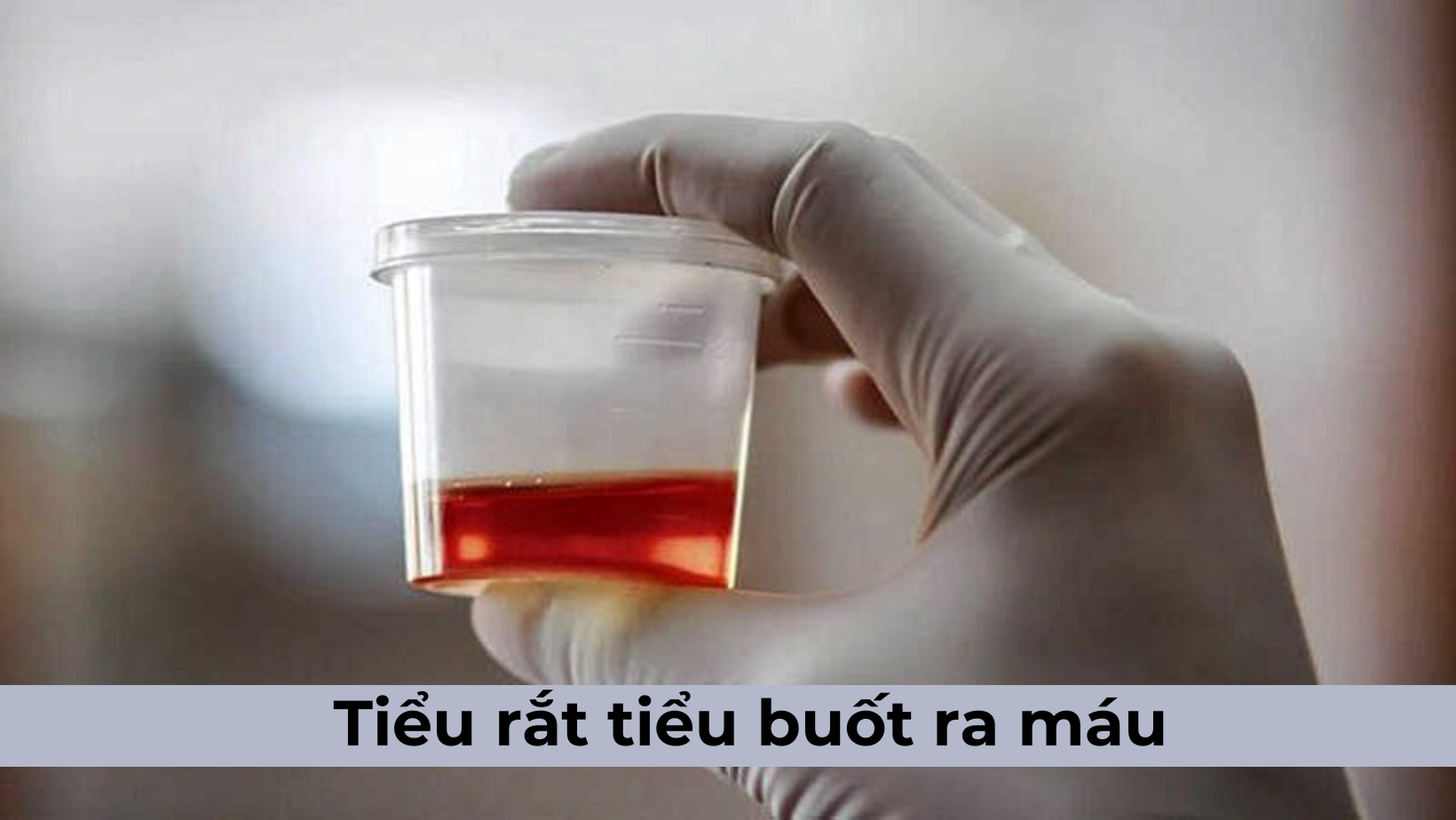 Tiểu rắt tiểu buốt ra máu