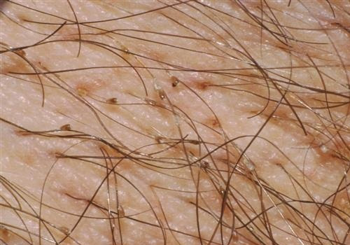 Thói quen sinh hoạt không lành mạnh