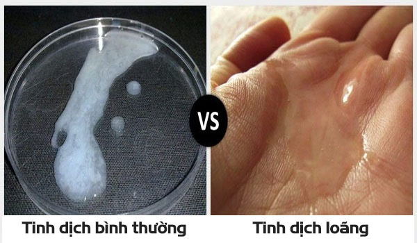 Biểu hiện của tinh trùng loãng