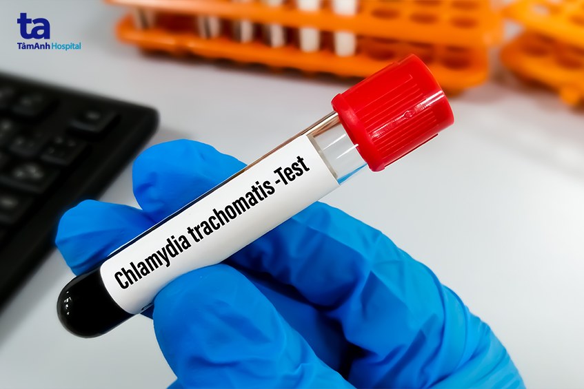 cách chuẩn đoán vi khuẩn chlamydia