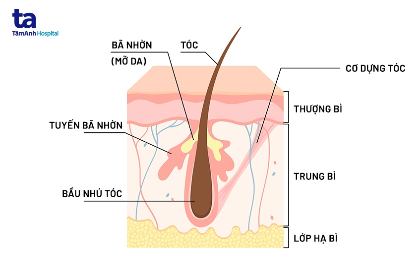 nguyên nhân hói đầu ở nữ