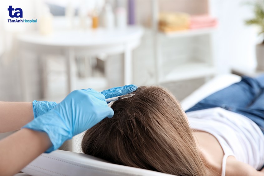 Điều trị rụng tóc ở nữ giới bằng phương pháp tiêm huyết tương giàu tiểu cầu