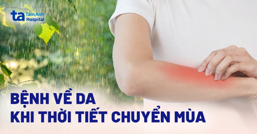 bệnh về da khi thời tiết chuyển mùa