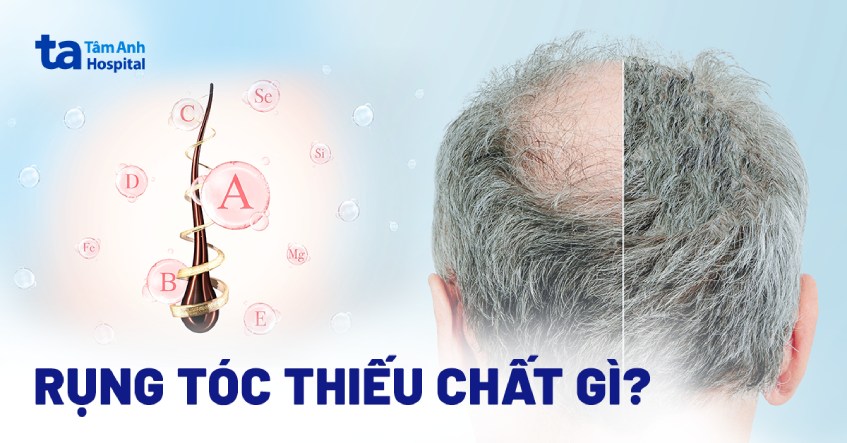 rụng tóc thiếu chất gì