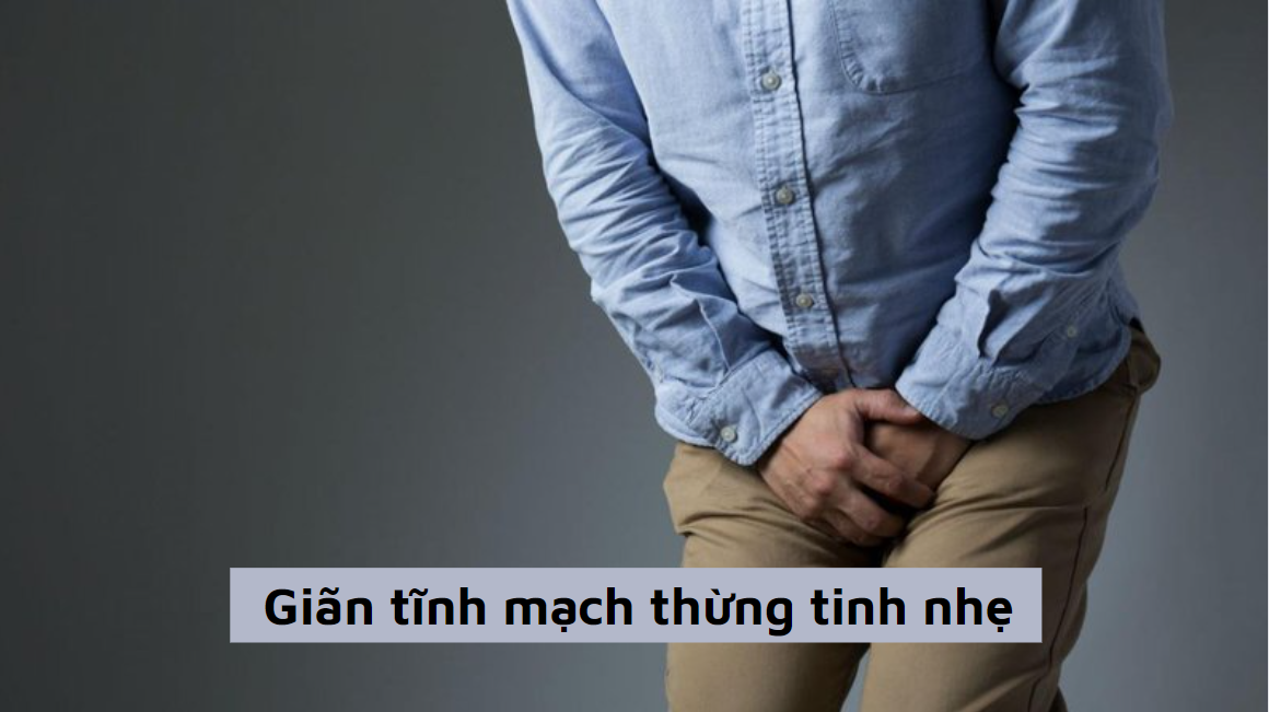 Giãn tĩnh mạch thừng tinh nhẹ
