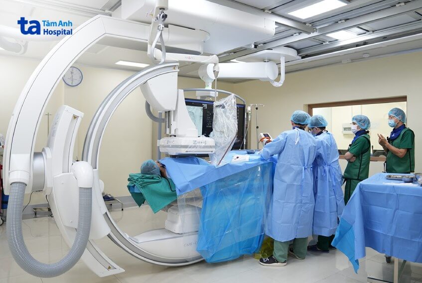 nút mạch trong điều trị bệnh ung thư gan