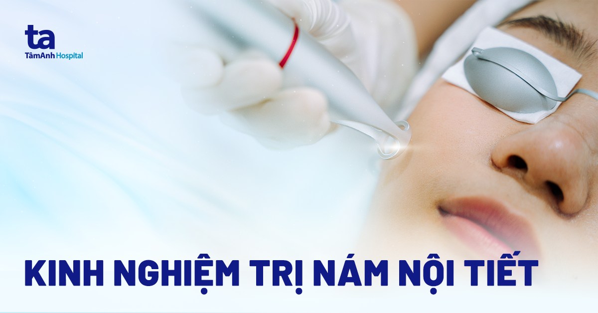 cách trị nám nội tiết