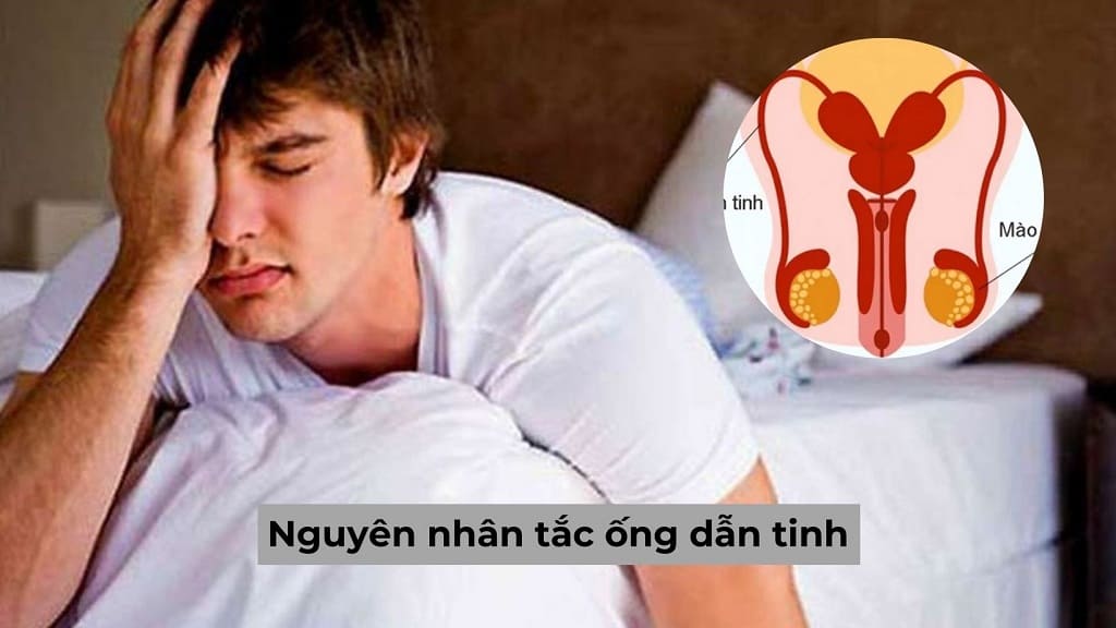 Nguyên nhân tắc ống dẫn tinh