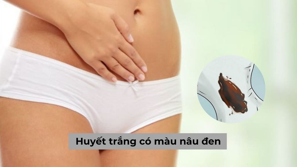 Huyết trắng có màu nâu đen