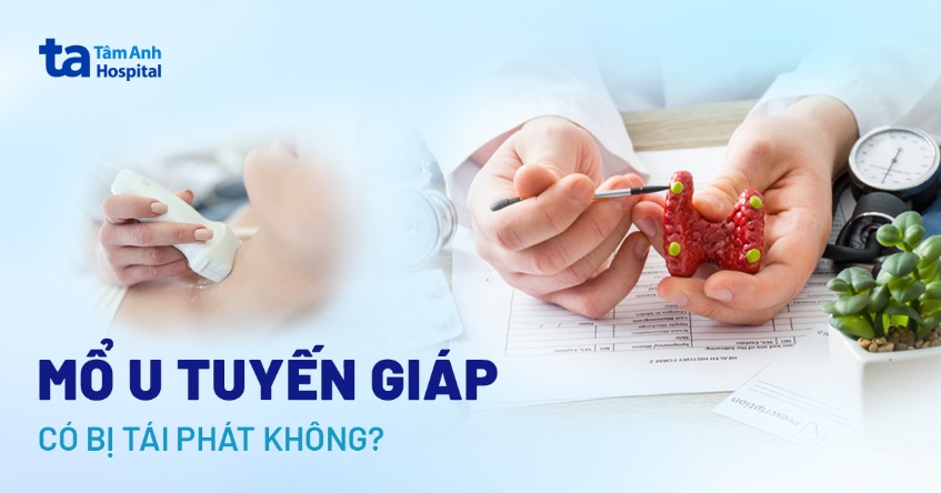 mổ u tuyến giáp có bị tái phát không