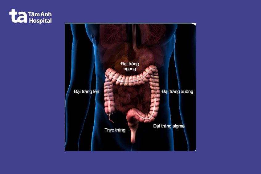 giải phẫu tầm soát ung thư đại trực tràng