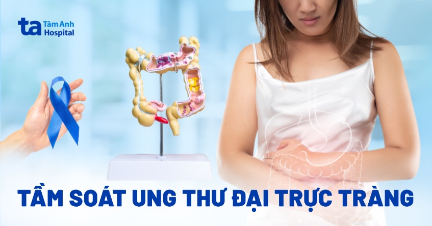 tầm soát ung thư đại trực tràng