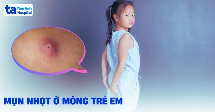 Mụn nhọt ở mông trẻ em