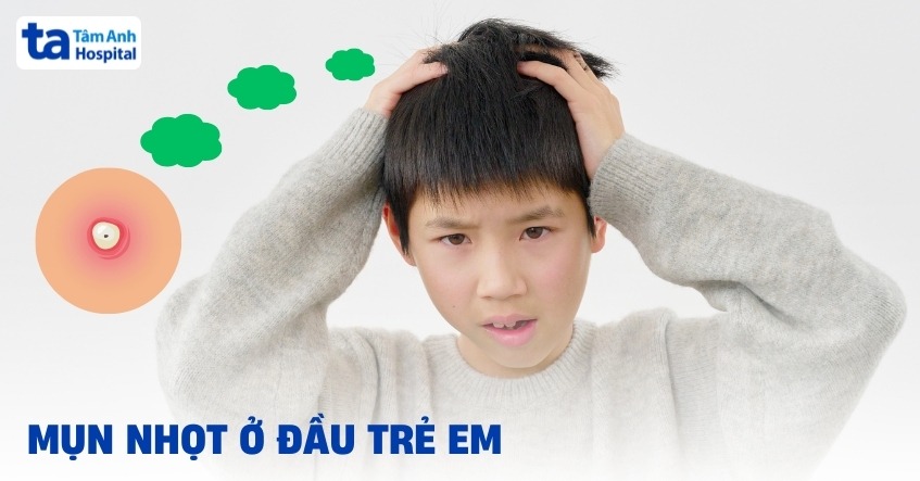 Mụn nhọt ở đầu trẻ em là gì