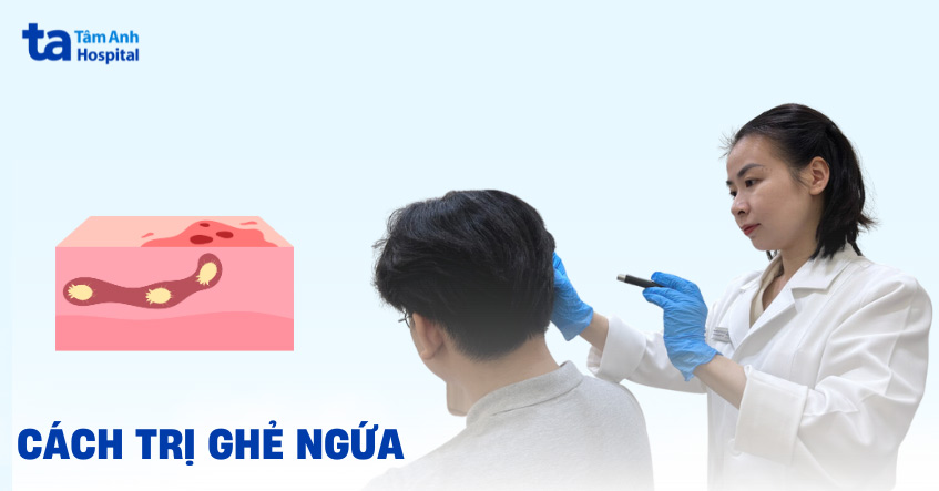 cách trị ghẻ ngứa tại nhà