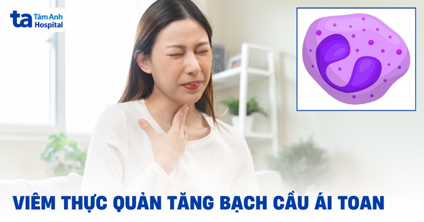 viêm thực quản tăng bạch cầu ái toan