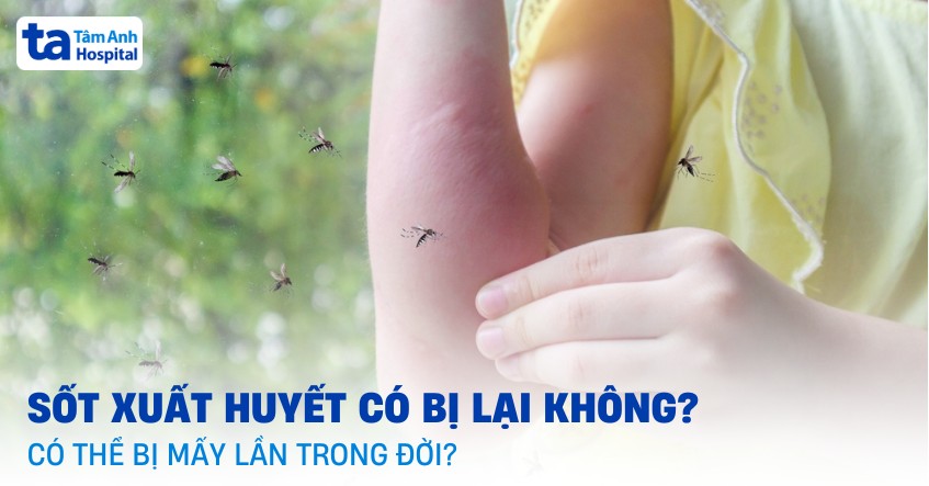 sốt xuất huyết có bị lại không