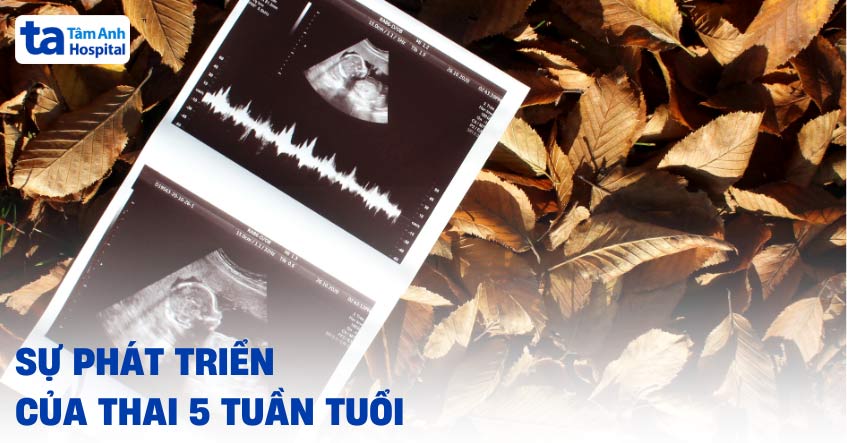 thai nhi 5 tuần tuổi