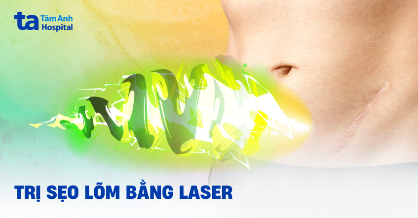 trị sẹo lõm bằng laser