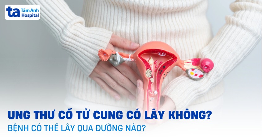 ung thư cổ tử cung có lây không