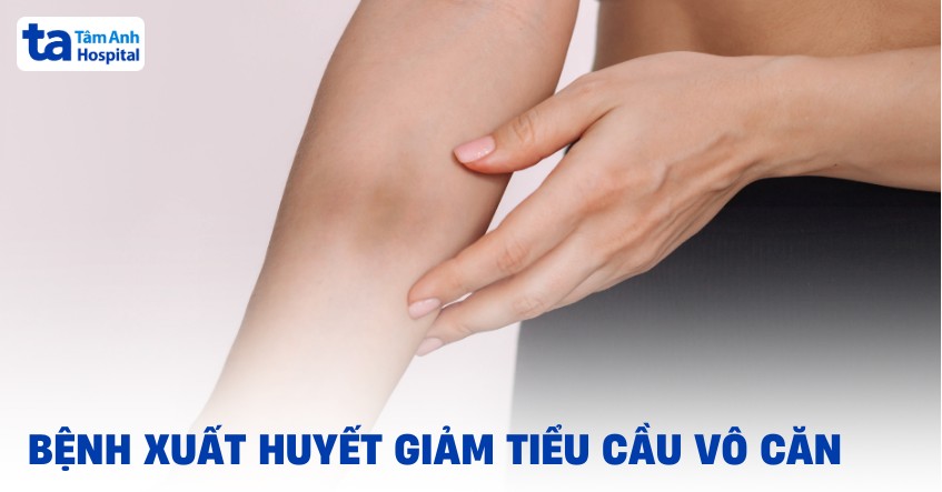 xuất huyết giảm tiểu cầu vô căn