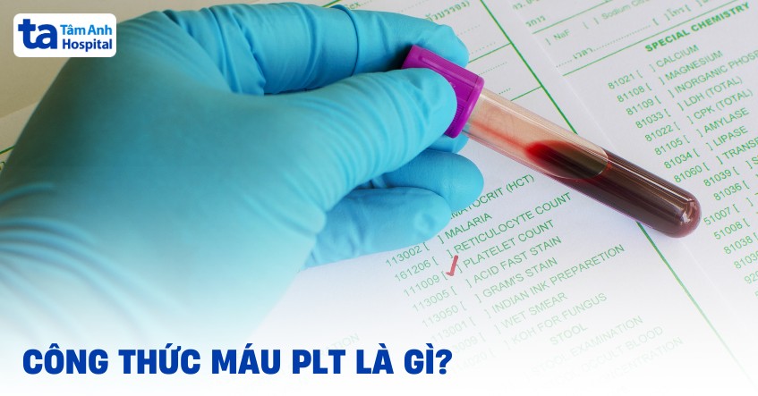 công thức máu plt