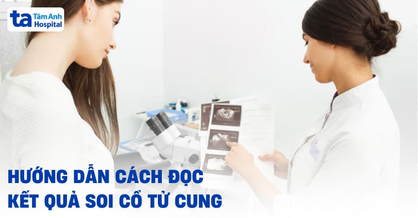 Hướng dẫn cách đọc kết quả soi cổ tử cung